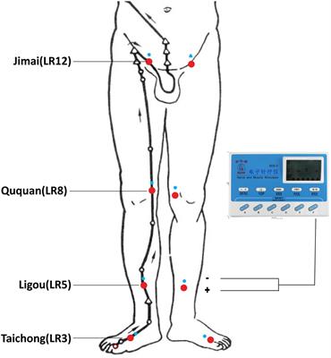 Frontiers Electroacupuncture for psychogenic erectile